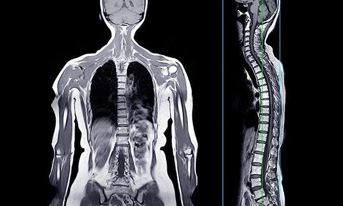 Whole-Body-MRI-Naples-FL